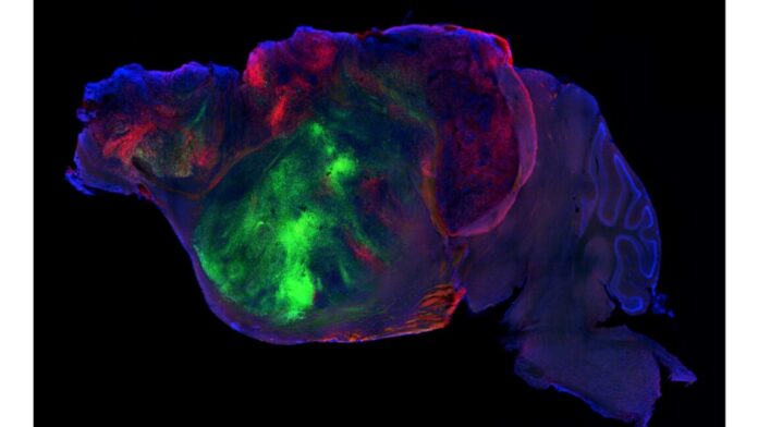 Scientists Replace Mouse Brain Cells with Human Neurons in Breakthrough for Neurological Research